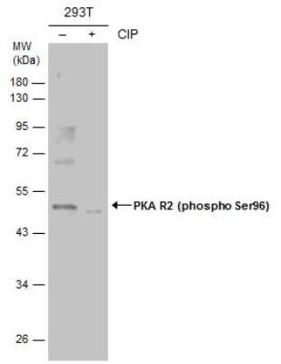 Western Blot: PKA R2 [p Ser96] Antibody [NBP3-12928]